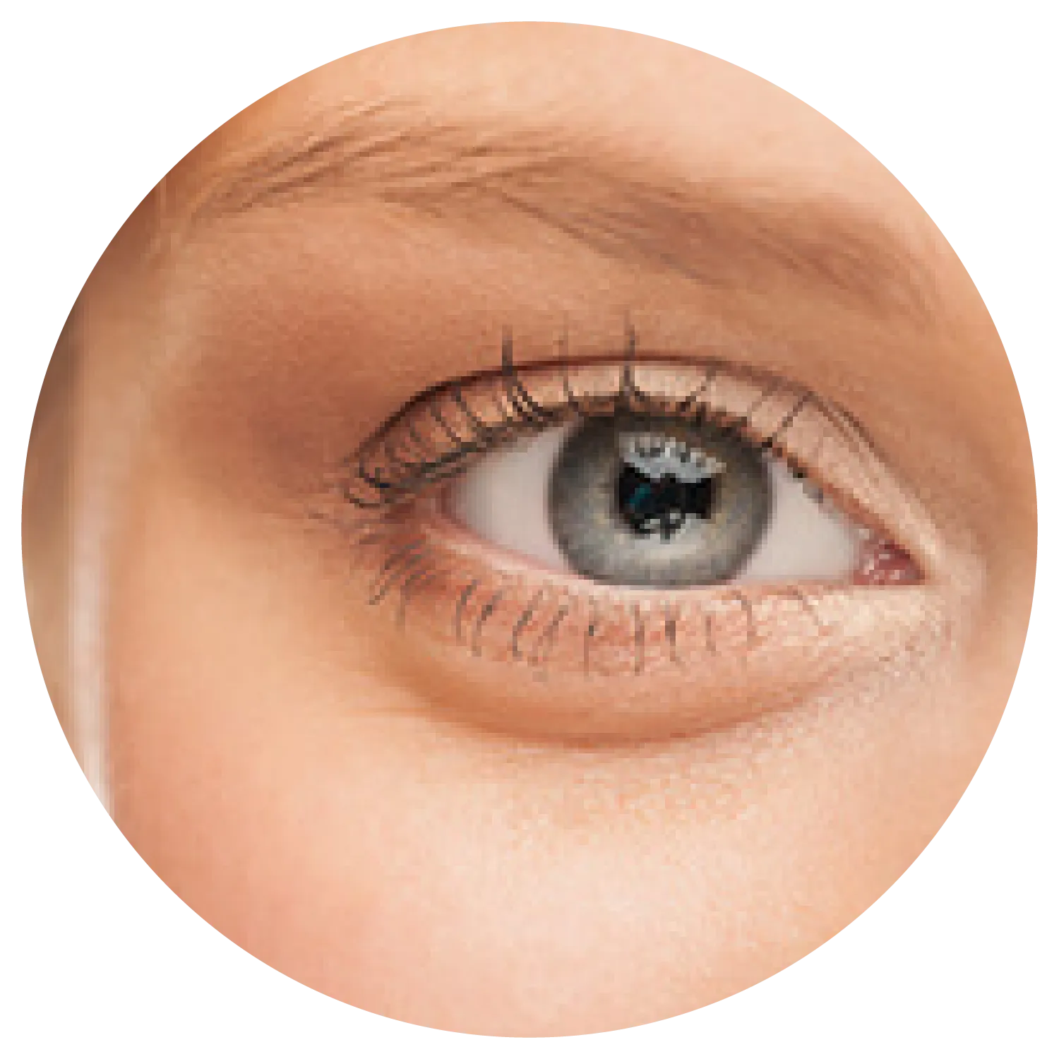 Excessive Eyelid Skin treatment results at Toronto medical spa - The Chain Reaction of Symptoms